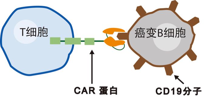 CAR-T免疫疗法：调动自身免疫系统杀灭肿瘤